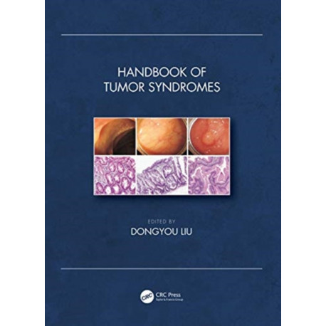 Handbook of Tumor Syndromes