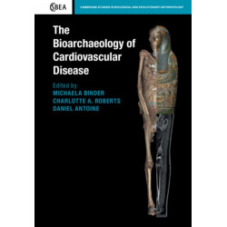 The Bioarchaeology of Cardiovascular Disease