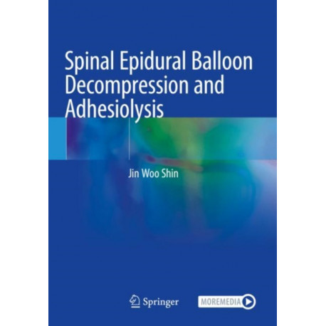 Spinal Epidural Balloon Decompression and Adhesiolysis