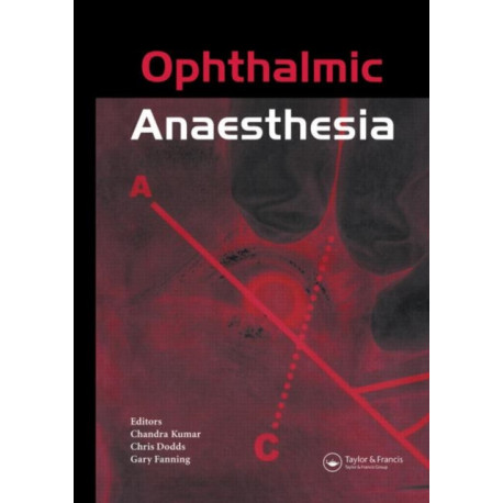 Ophthalmic Anaesthesia