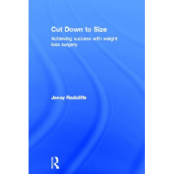 Cut Down to Size: Achieving success with weight loss surgery