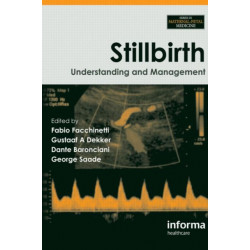 Stillbirth: Understanding and Management