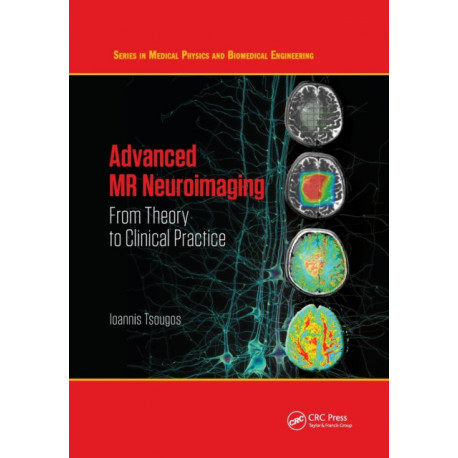 Advanced MR Neuroimaging: From Theory to Clinical Practice