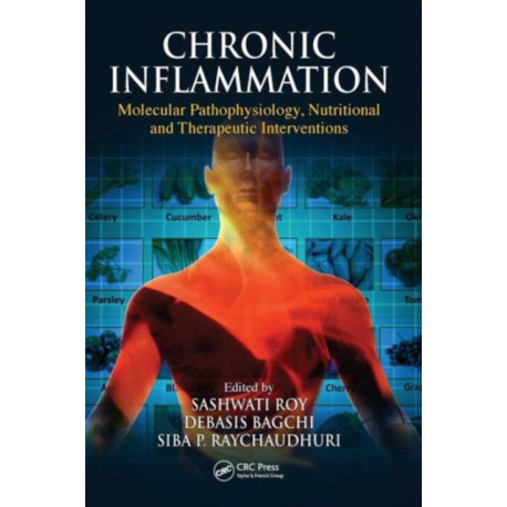 Chronic Inflammation: Molecular Pathophysiology, Nutritional and Therapeutic Interventions