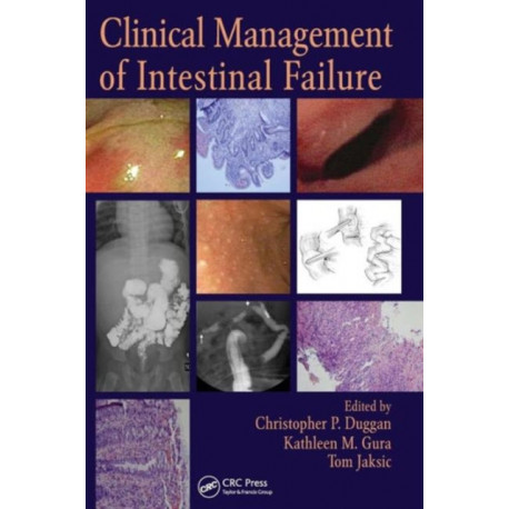 Clinical Management of Intestinal Failure