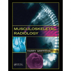 Musculoskeletal Radiology