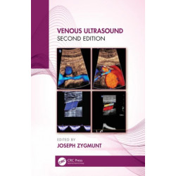 Venous Ultrasound