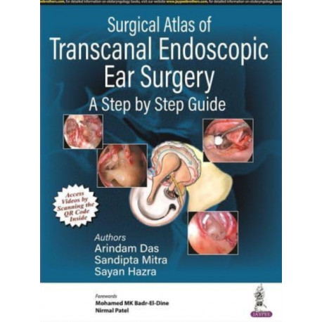 Surgical Atlas of Transcanal Endoscopic Ear Surgery: A Step by Step Guide