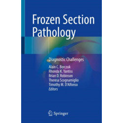 Frozen Section Pathology: Diagnostic Challenges