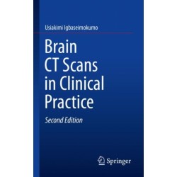 Brain CT Scans in Clinical Practice