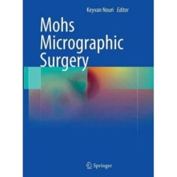 Mohs Micrographic Surgery