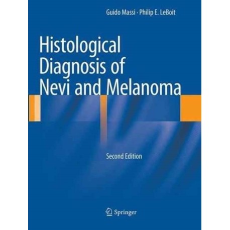 Histological Diagnosis of Nevi and Melanoma