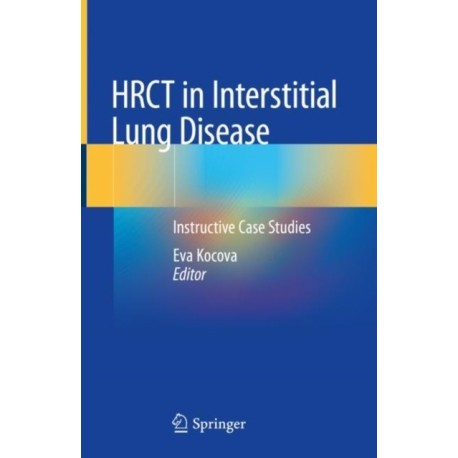 HRCT in Interstitial Lung Disease: Instructive Case Studies
