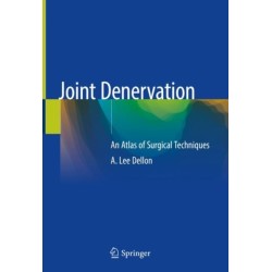 Joint Denervation: An Atlas of Surgical Techniques