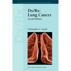 Dx/Rx: Lung Cancer: Lung Cancer