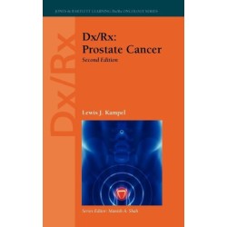 Dx/Rx: Prostate Cancer: Prostate Cancer