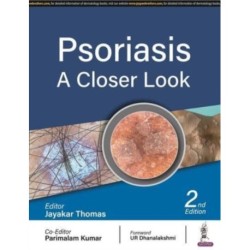 Psoriasis: A Closer Look
