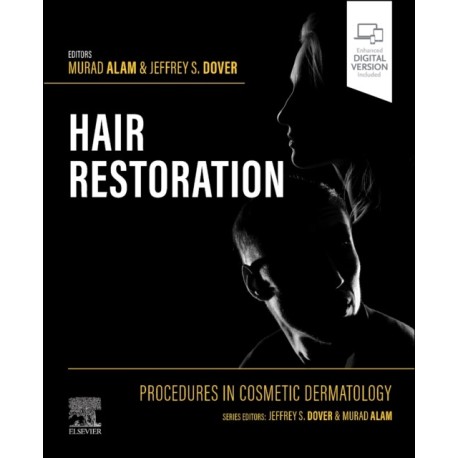 Procedures in Cosmetic Dermatology: Hair Restoration
