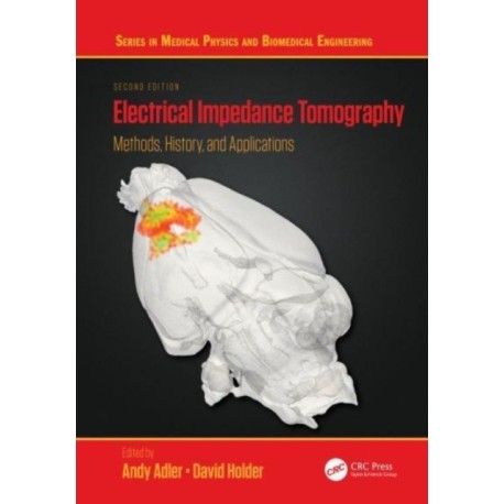 Electrical Impedance Tomography: Methods, History and Applications