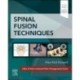 Spinal Fusion Techniques