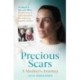 Precious Scars