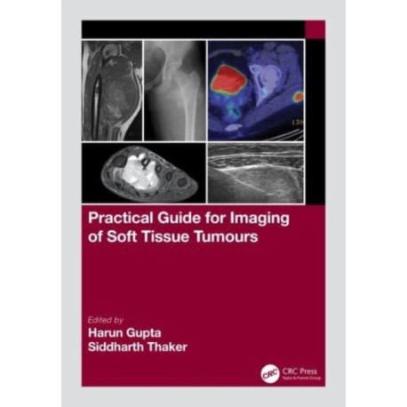 Practical Guide for Imaging of Soft Tissue Tumours