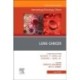 Lung Cancer, An Issue of Hematology/Oncology Clinics of North America