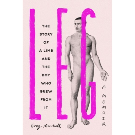 Leg: The Story of a Limb and the Boy Who Grew from It
