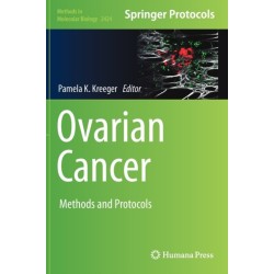 Ovarian Cancer: Methods and Protocols