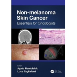Non-melanoma Skin Cancer: Essentials for Oncologists