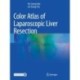 Color Atlas of Laparoscopic Liver Resection