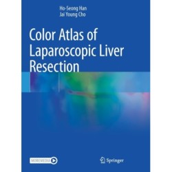 Color Atlas of Laparoscopic Liver Resection