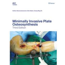 Minimally Invasive Plate Osteosynthesis