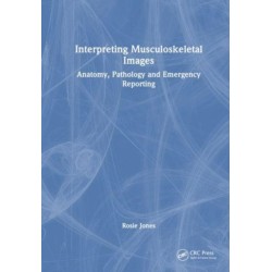 Interpreting Musculoskeletal Images: Anatomy, Pathology and Emergency Reporting
