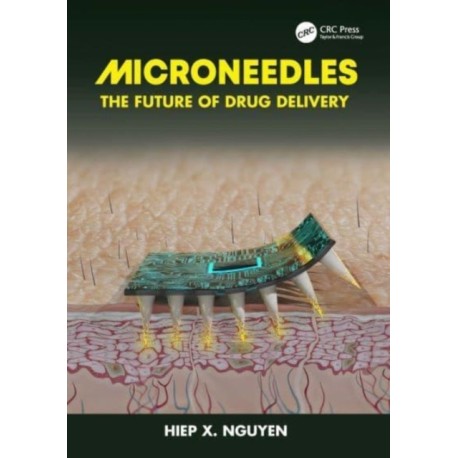 Microneedles: The Future of Drug Delivery