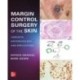 Margin Control Surgery of the Skin: Concepts, Histopathology, and Applications