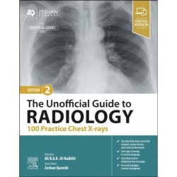 The Unofficial Guide to Radiology: 100 Practice Chest X-rays