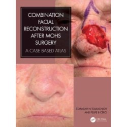 Combination Facial Reconstruction after Mohs Surgery: A Case Based Atlas
