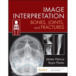 Image Interpretation: Bones, Joints, and Fractures