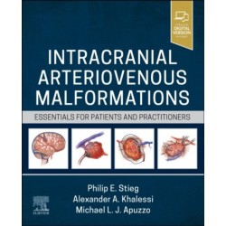 Intracranial Arteriovenous Malformations: Essentials for Patients and Practitioners