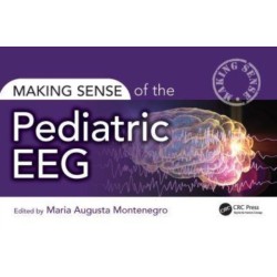 Making Sense of the Pediatric EEG