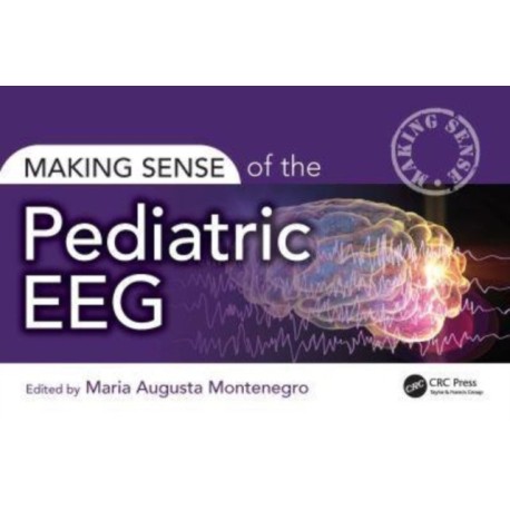 Making Sense of the Pediatric EEG