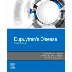 Dupuytren's Disease: A Scientific Review