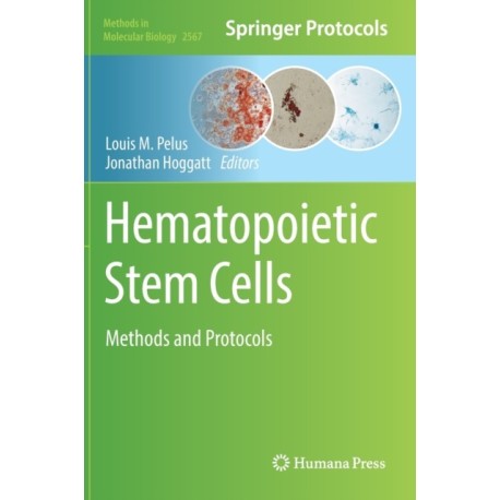 Hematopoietic Stem Cells: Methods and Protocols