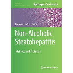 Non-Alcoholic Steatohepatitis: Methods and Protocols