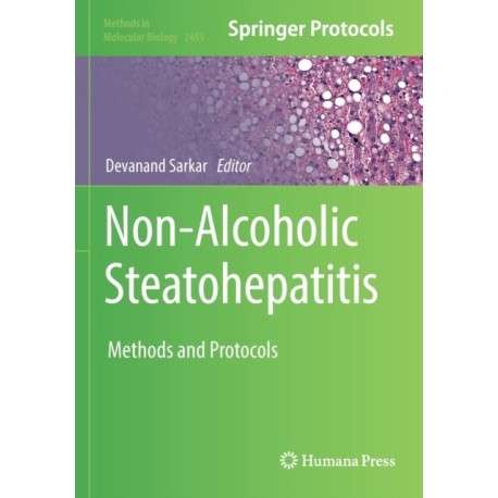 Non-Alcoholic Steatohepatitis: Methods and Protocols