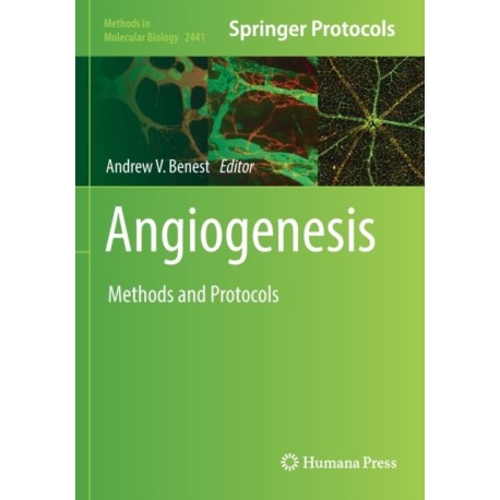 Angiogenesis: Methods and Protocols