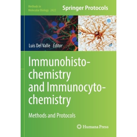 Immunohistochemistry and Immunocytochemistry: Methods and Protocols