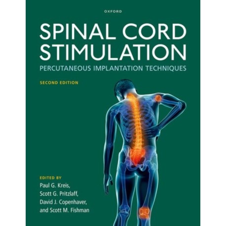 Spinal Cord Stimulation: Percutaneous Implantation Techniques