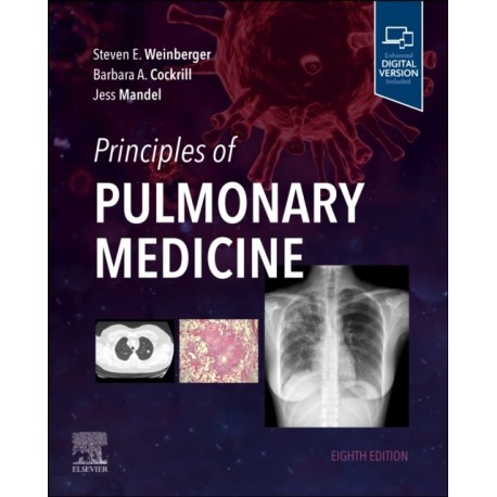 Principles of Pulmonary Medicine